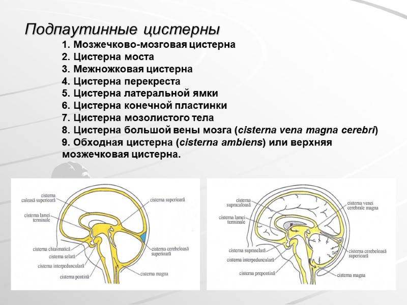 Подпаутинные цистерны 1. Мозжечково-мозговая цистерна  2. Цистерна моста 3. Межножковая цистерна  4.